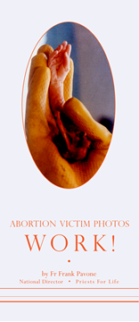 Abortion Victim Photos Work!