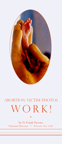 Abortion Victim Photos Work!